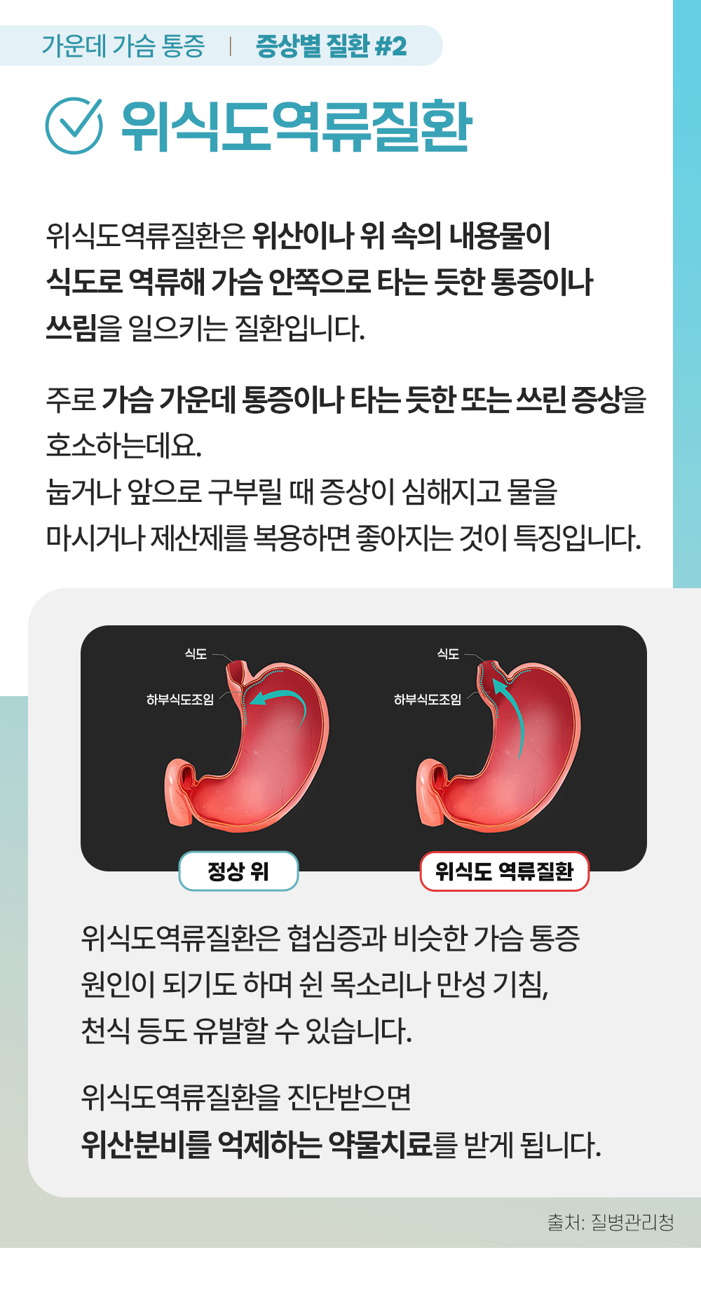 늑막염
