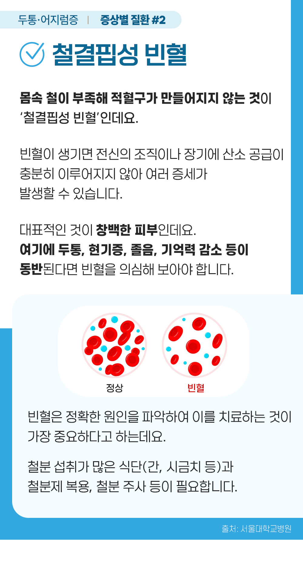 증상백과 머리찌릿