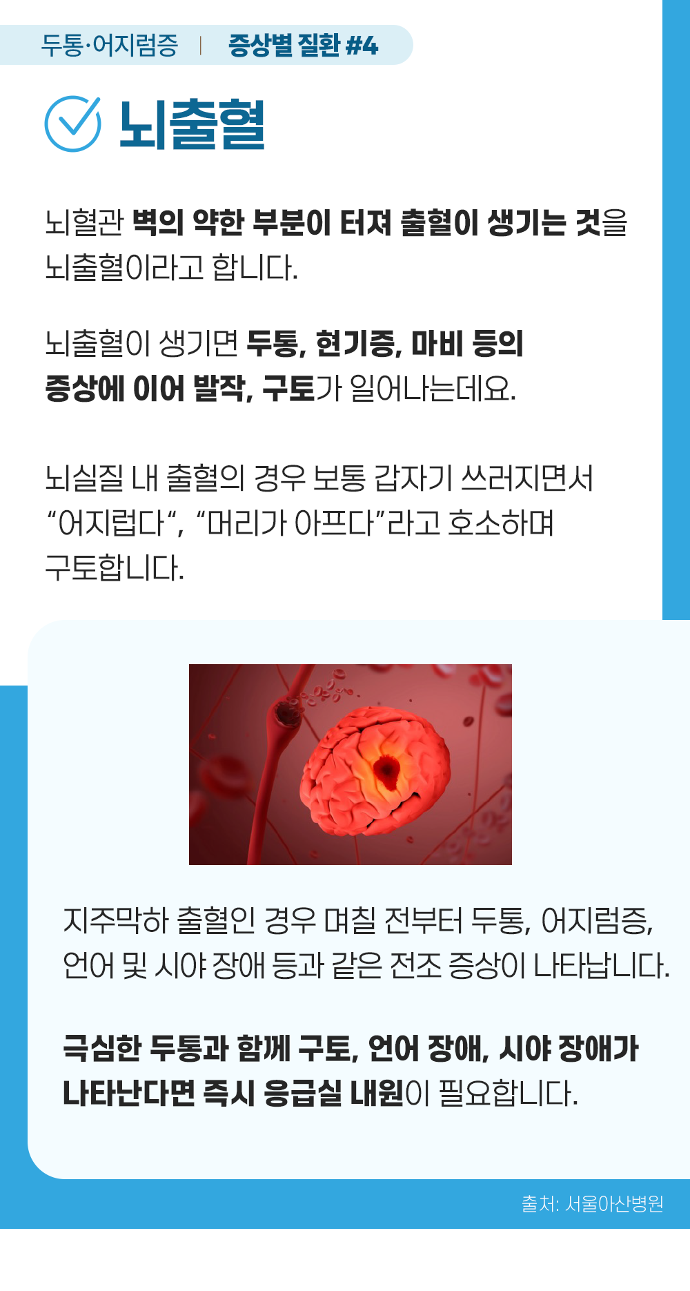 증상백과 머리찌릿