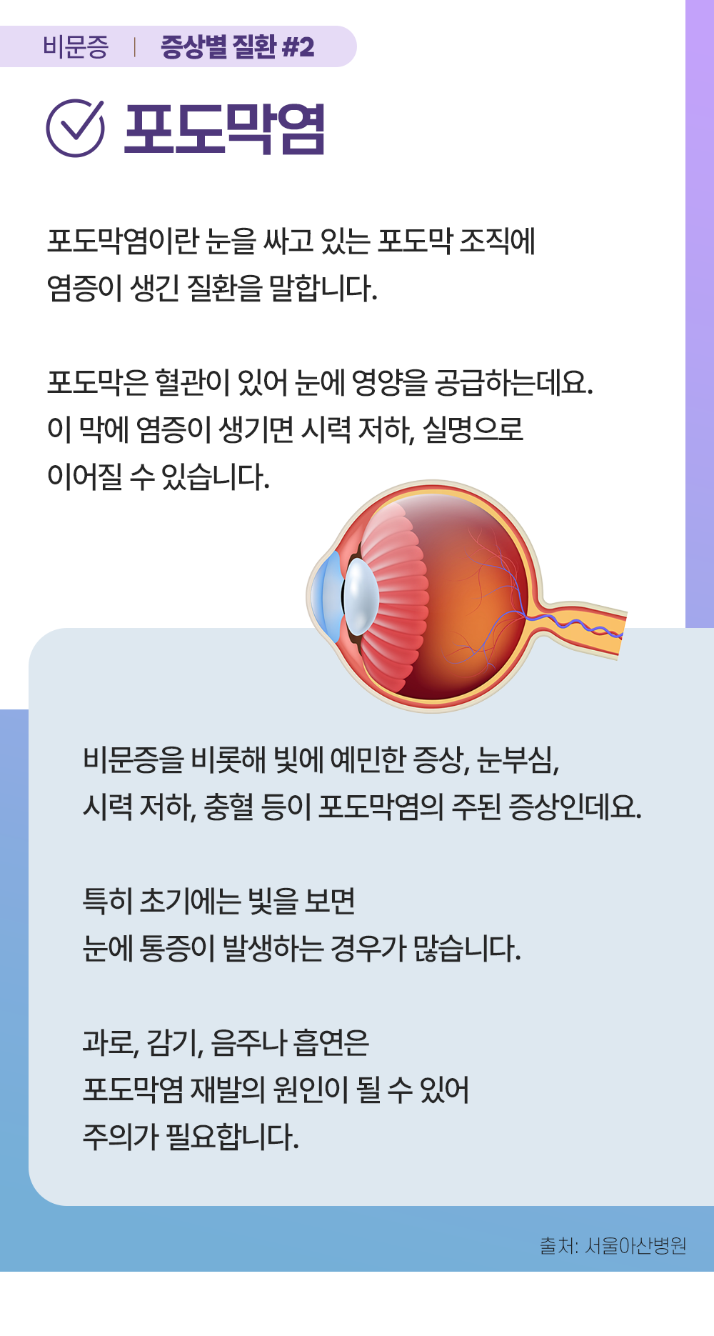 증상백과 비문증 s03