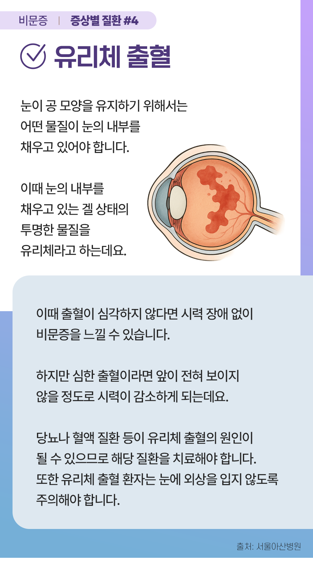 증상백과 비문증 s05