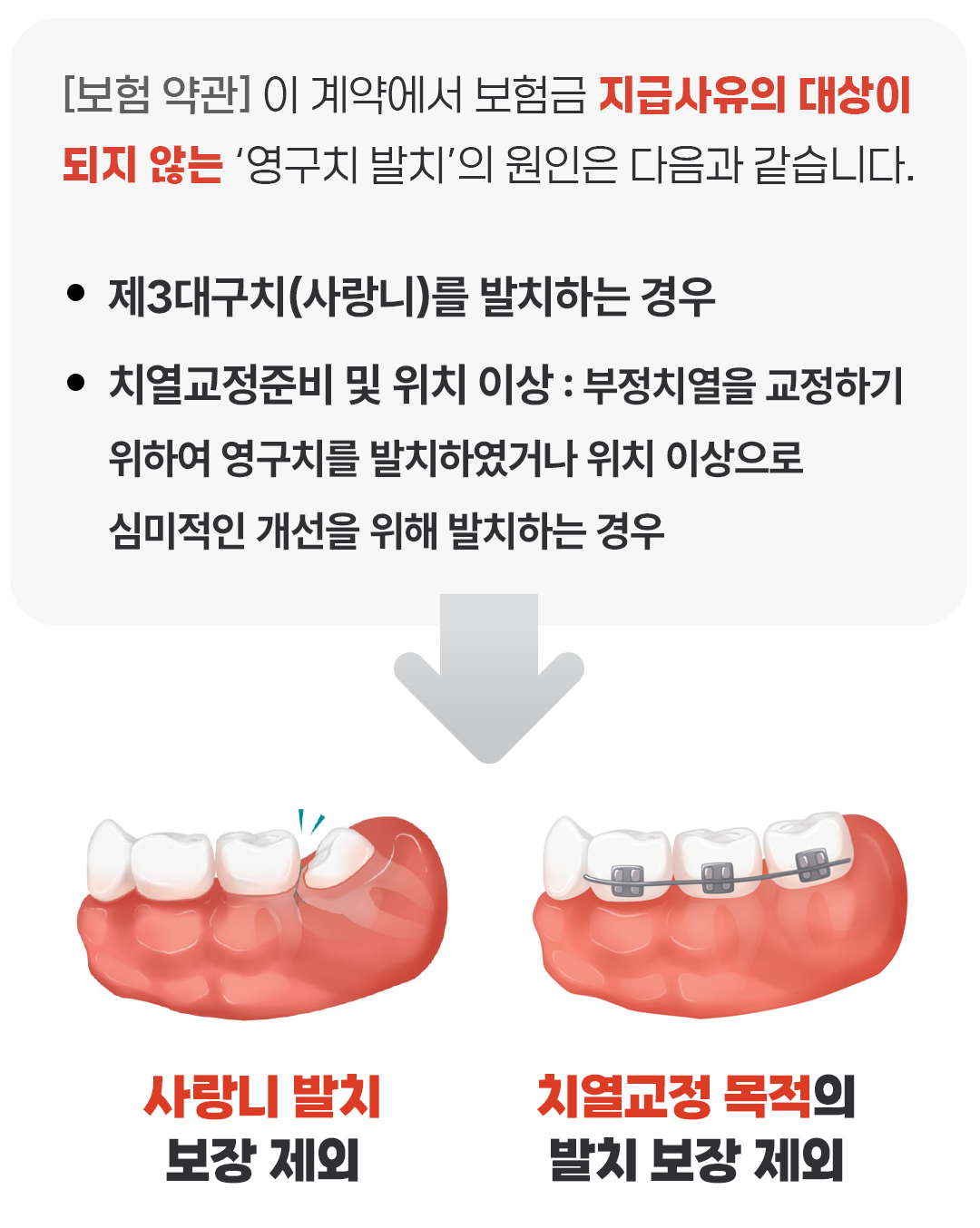 보험무물 사랑니02