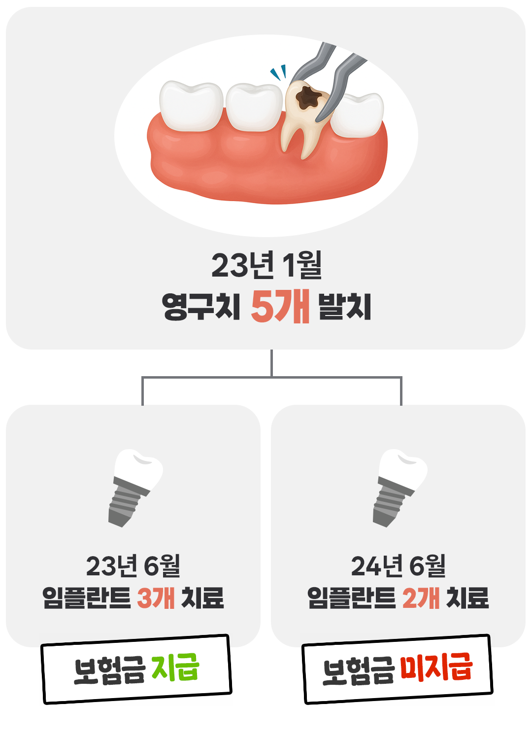 보험무물 사랑니03
