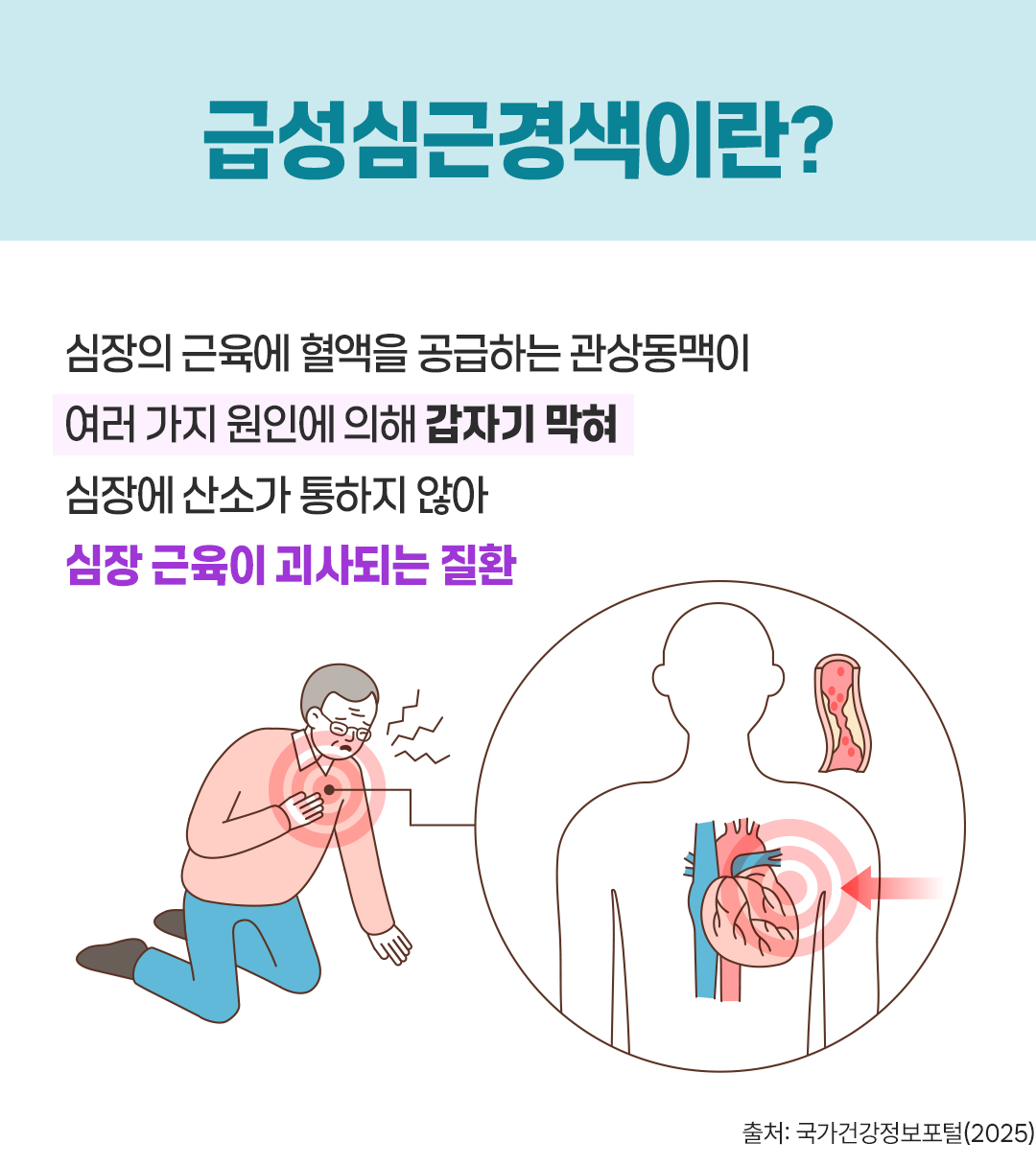 건강보험톡 급성심근경색 정의 심장 근육 괴사 질환