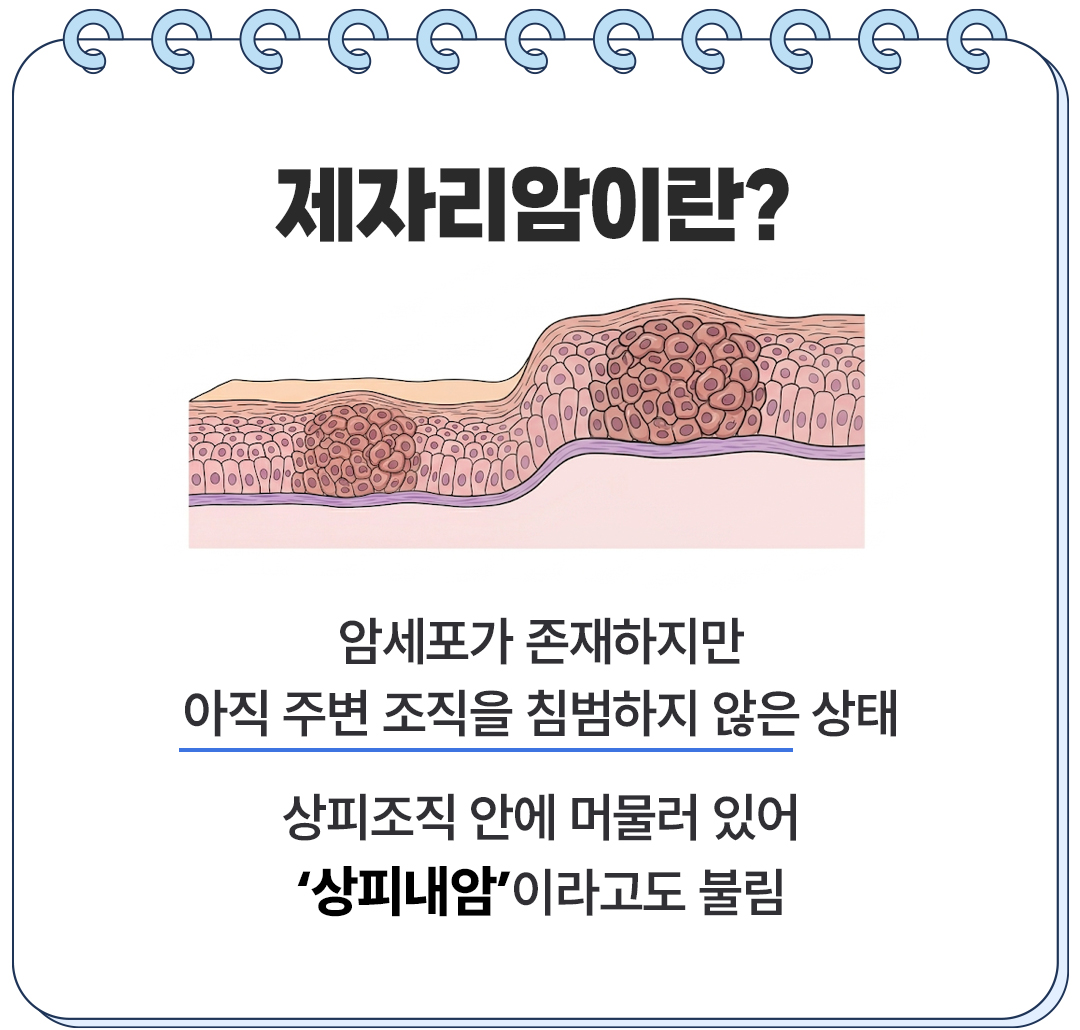보험무물 제자리암 유사암