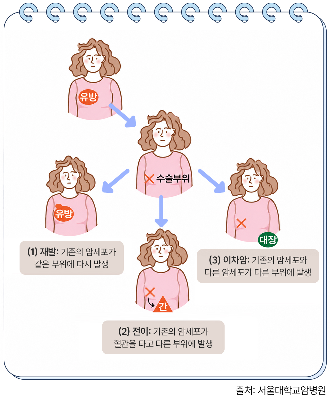 보험무물 전이암
